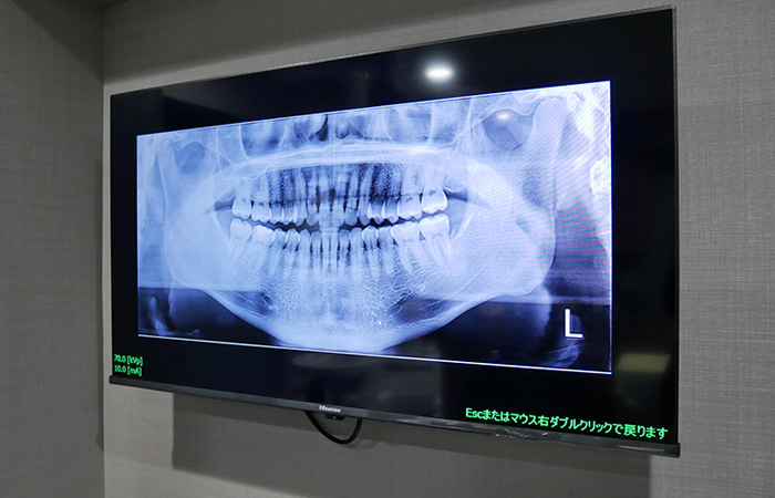 説明用モニター